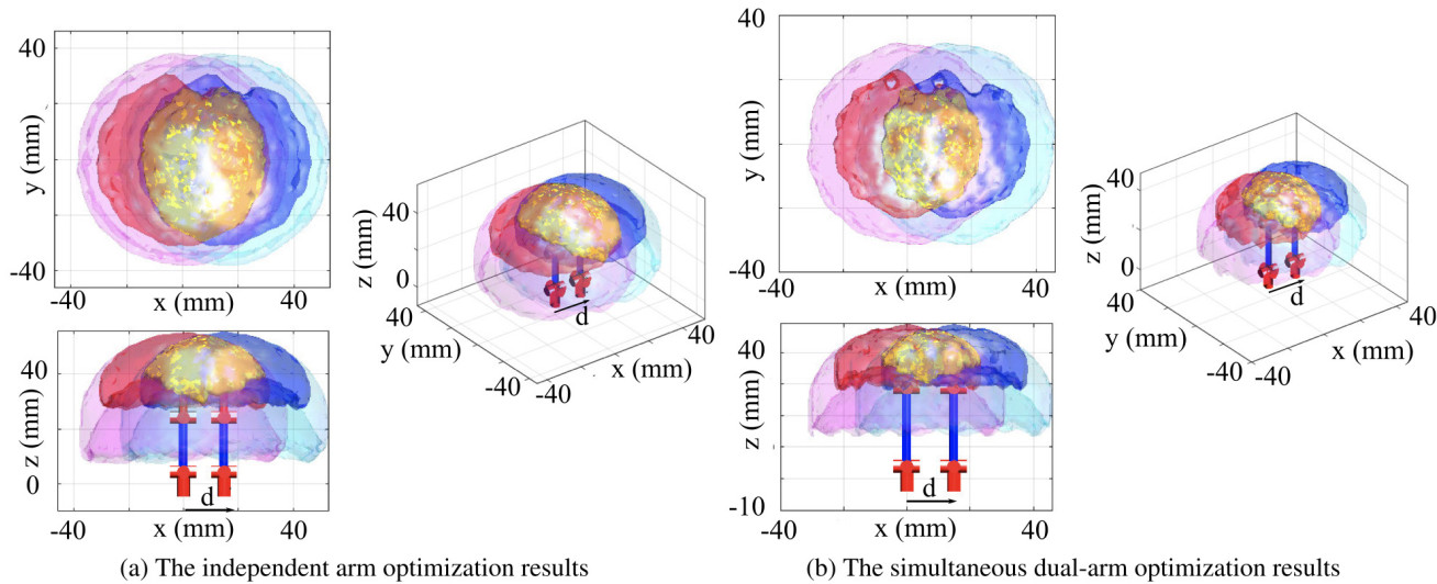The optimal designs and the surgical robot’s WS from a) independent arm optimisation; b) simultaneous dual-arm optimisation.