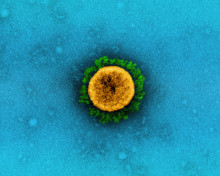 SARS-CoV-2