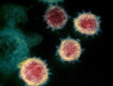 virus