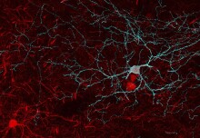 New £50m MRC Centre to develop brain stimulation device-based therapies